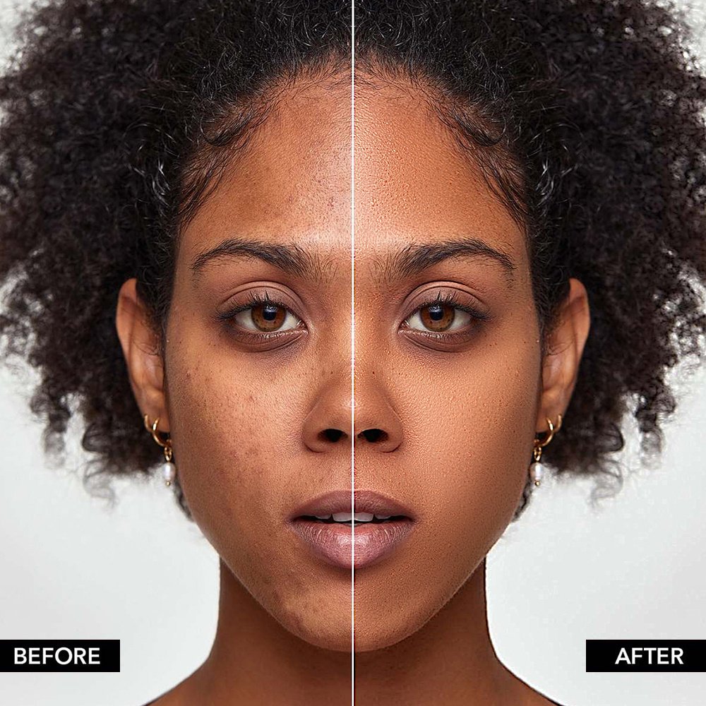 Quiet Veil Foundation - Image 2